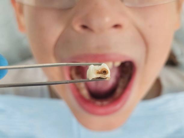Best Emergency Dental Extractions in Liberty City, TX